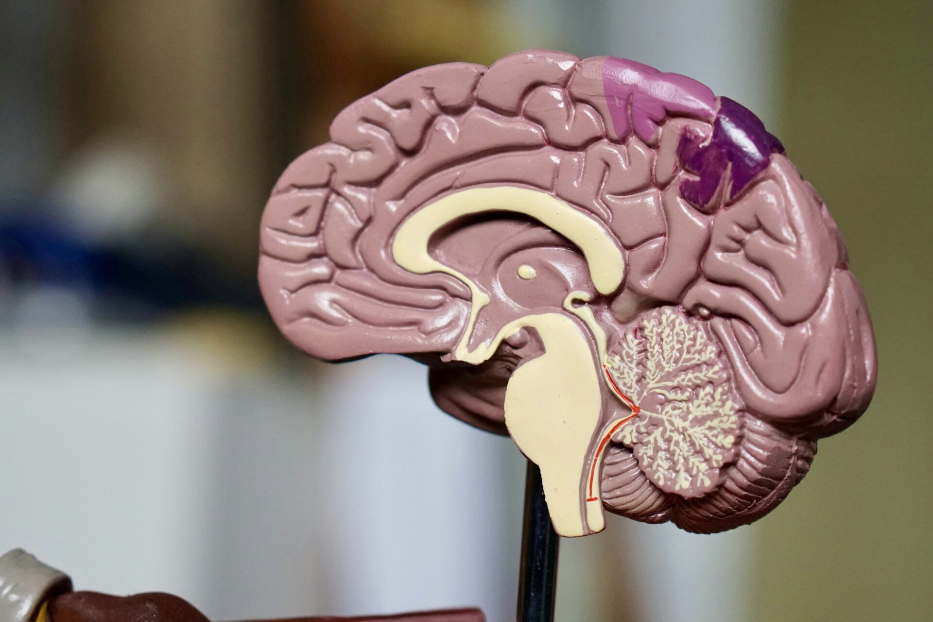 Cross section of a brain